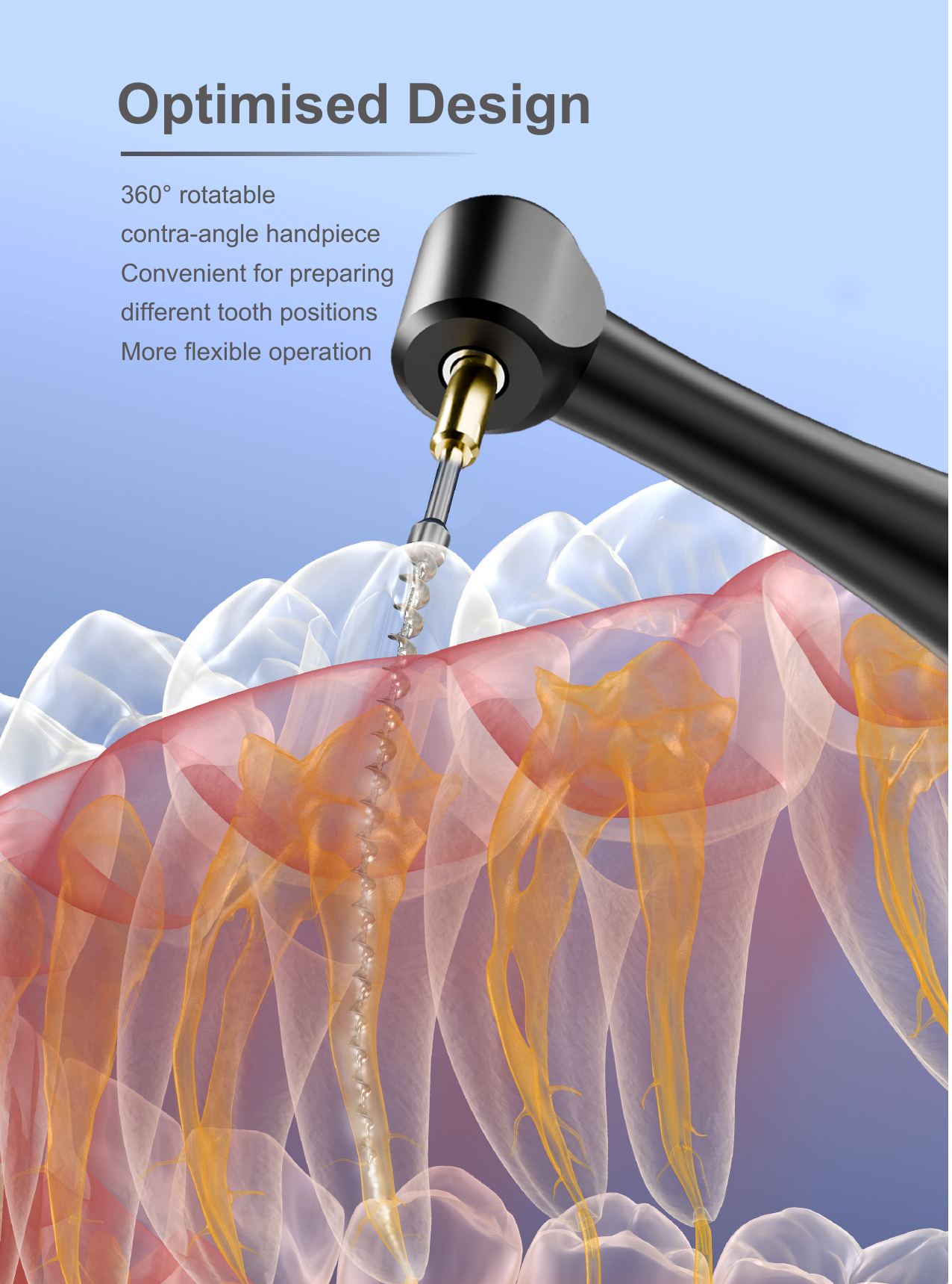 Xpedent Endo Motor Motosync Pro