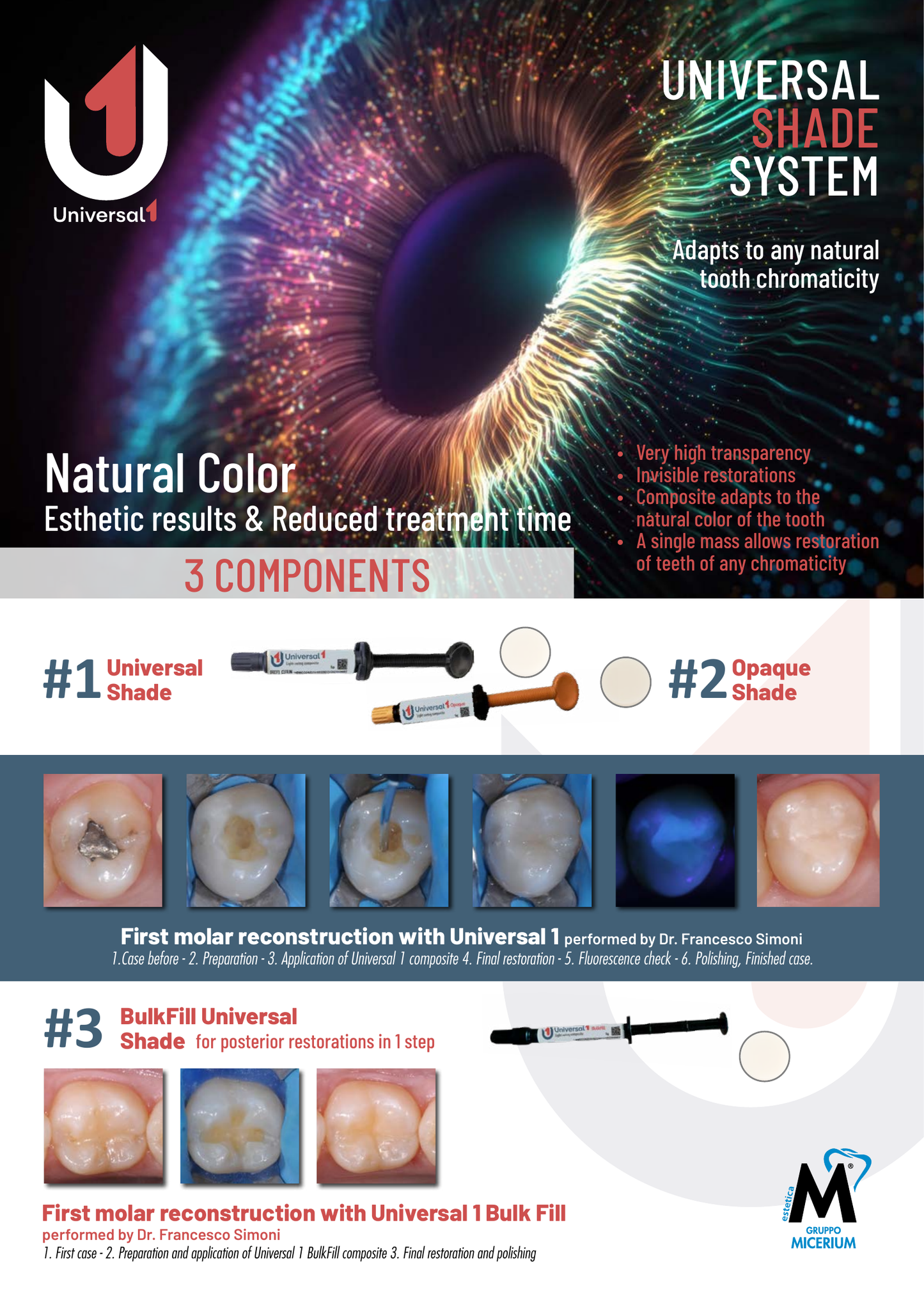 MICERIUM Universal 1 Light Curing Composite(5g)