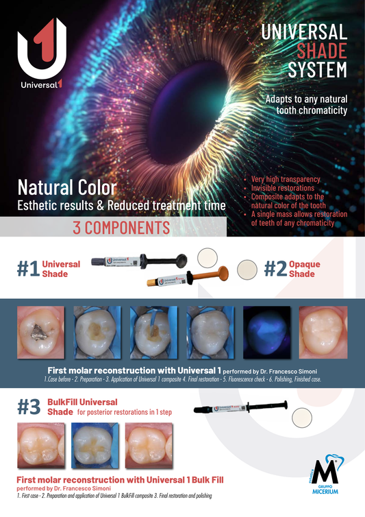 MICERIUM Universal 1 Light Curing Composite Bulkfill (2g)